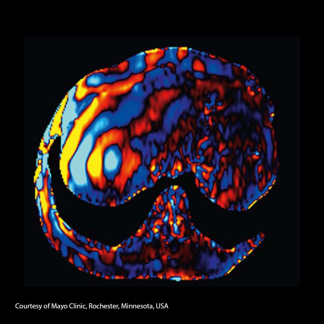 Wave image obtained by mechanical waves while measuring with a motion sensitive MR sequence