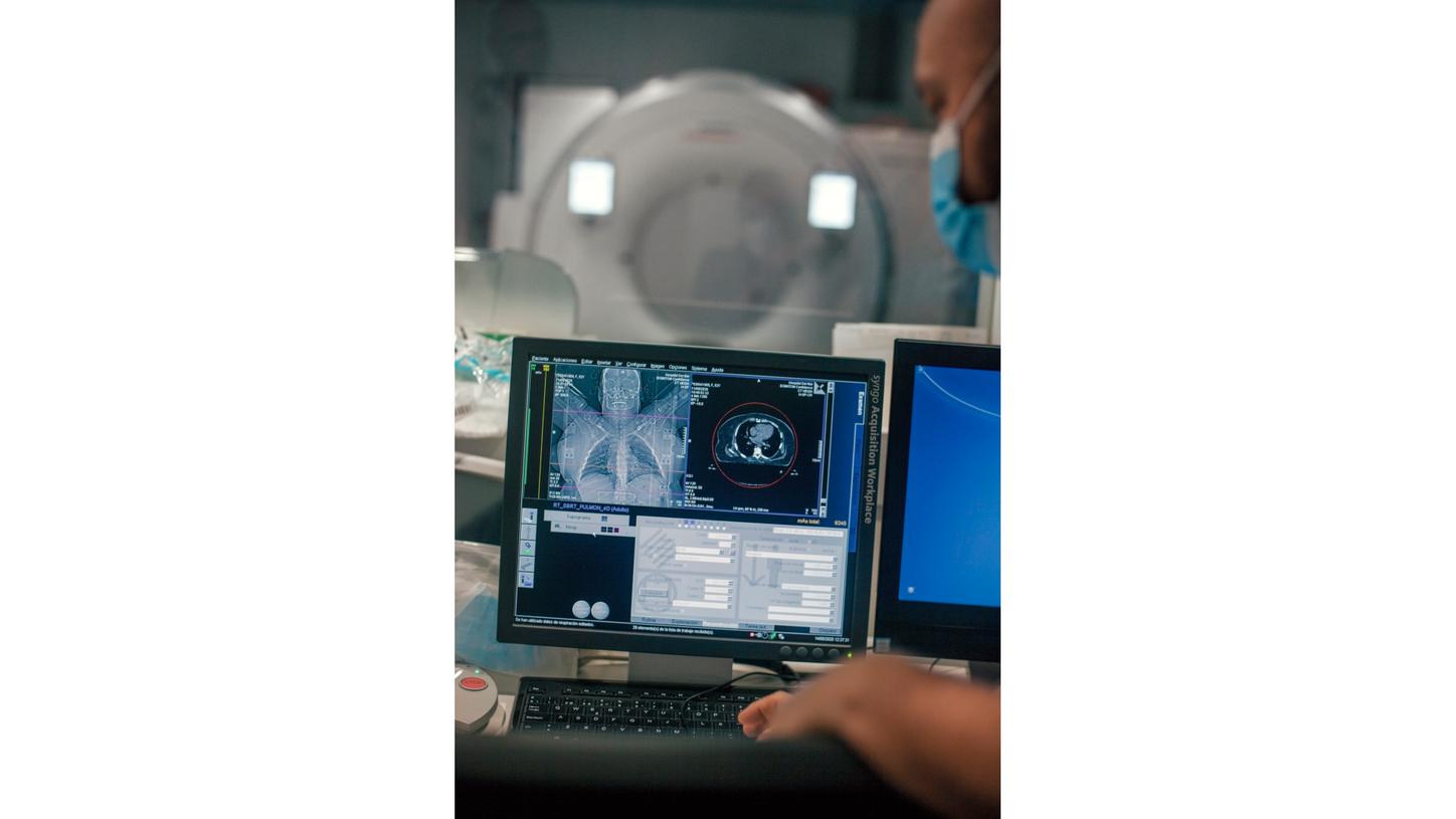 CT images are the basis for treatment planning in radiation therapy.