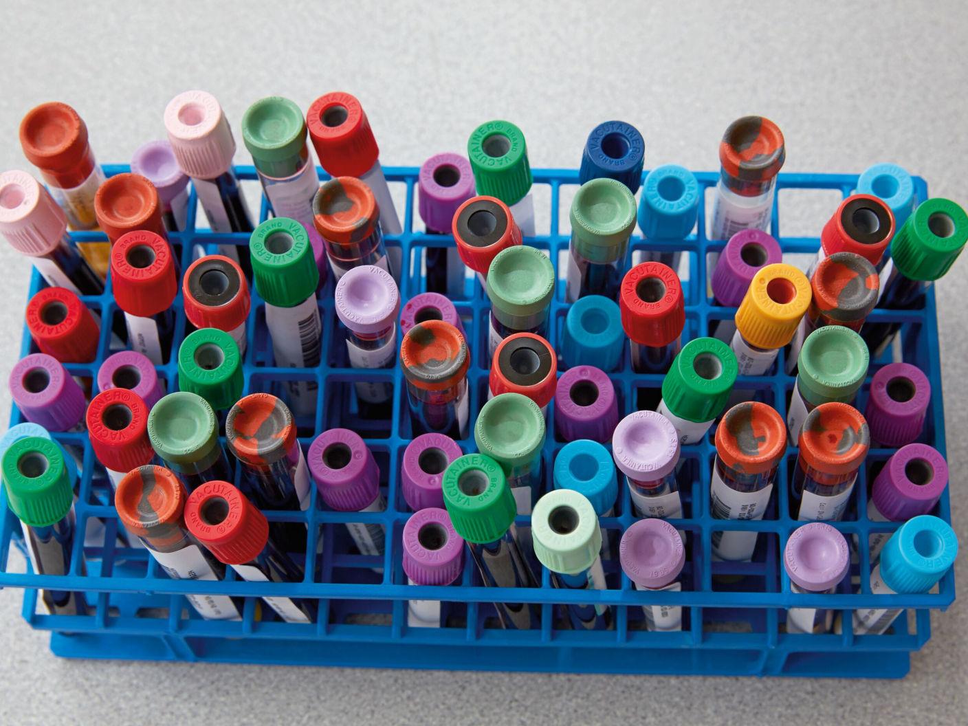 A lab rack with various kinds of test tubes in it shown from above