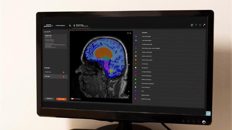 The software automatically labels the different regions of the brain, such as the hippocampi and the lobes.