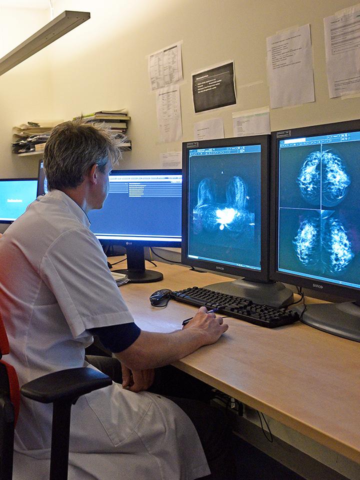 When evaluation mammography images, radiologists at Radboud University Medical Center are supported by artificial intelligence.