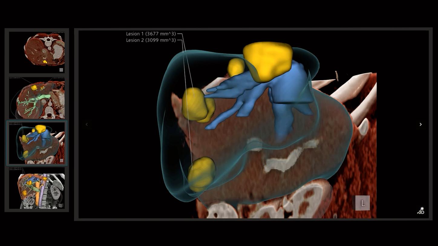 To visualize healthcare data, Kaloian Petkov uses 3D data visualization, which borrows techniques from other fields such as computer graphics and even the entertainment industry, as well as design and manufacturing. 