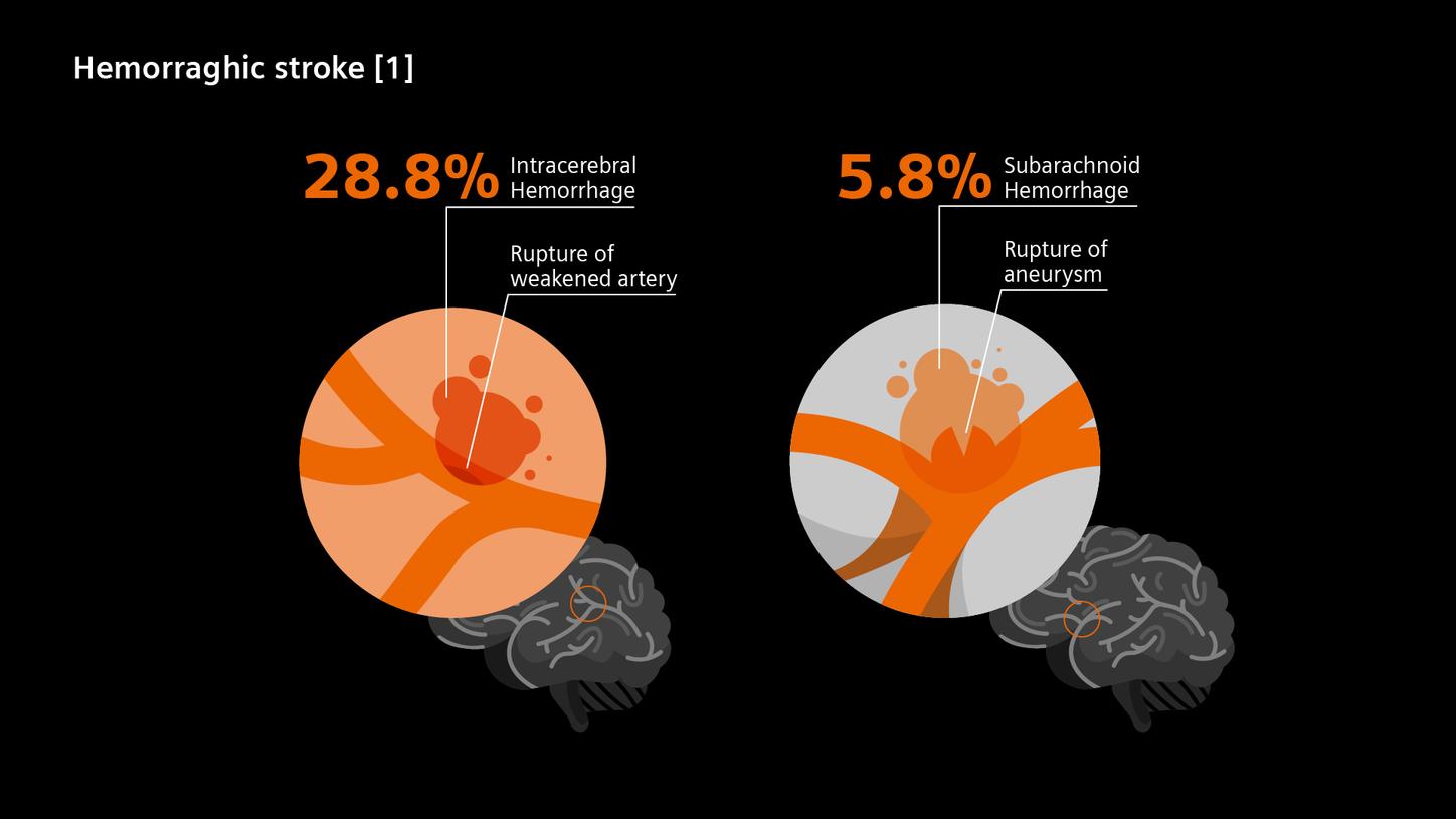 Anything that damages or breaks blood vessels in your brain can cause hemorraghic stroke.