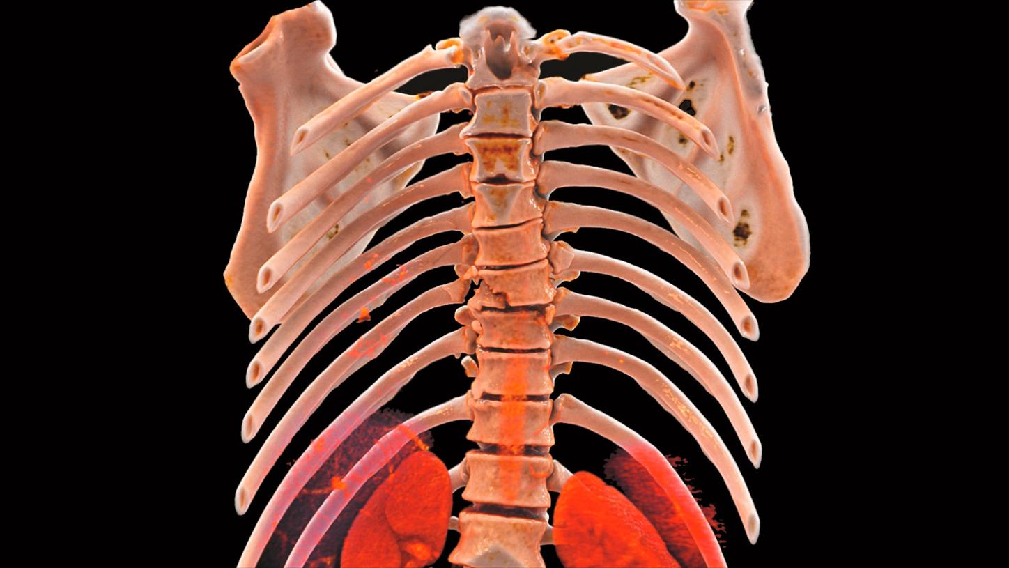 CT Acute Care Engine<br />
