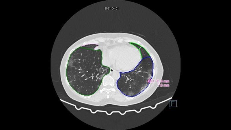 Diagnosis & Therapy Decision