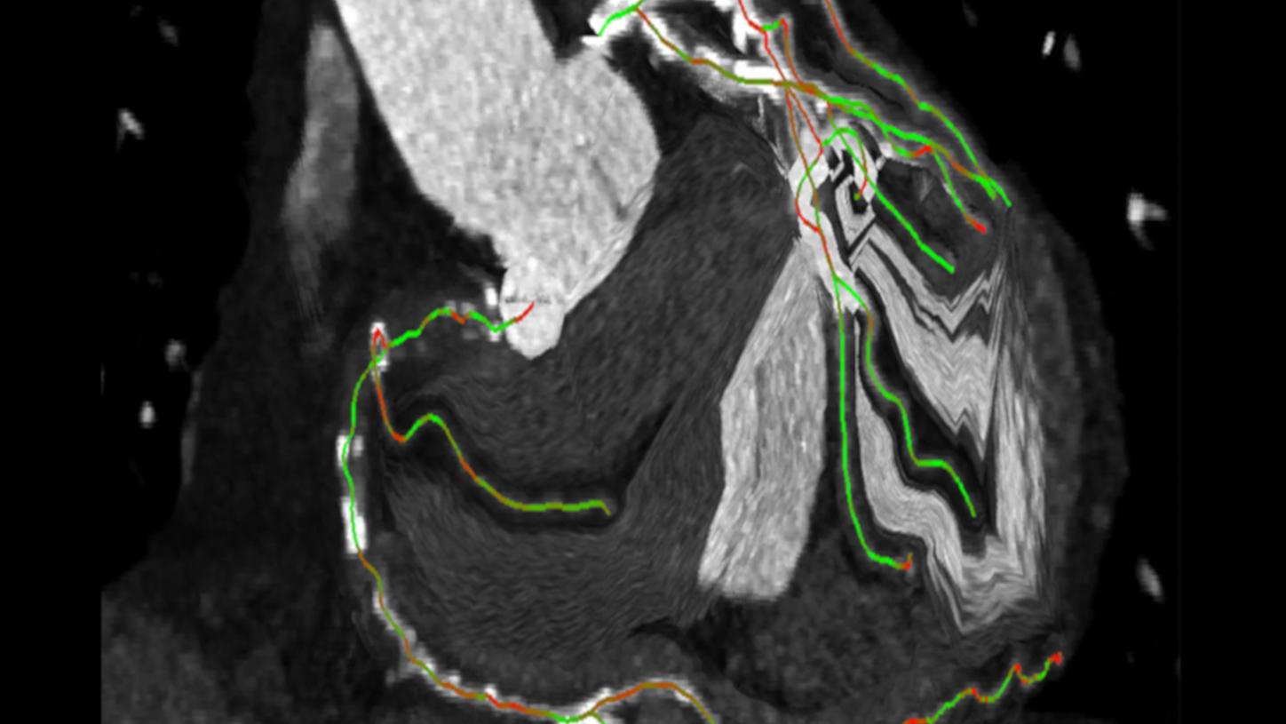 Options and upgrades for Interventional Imaging Systems