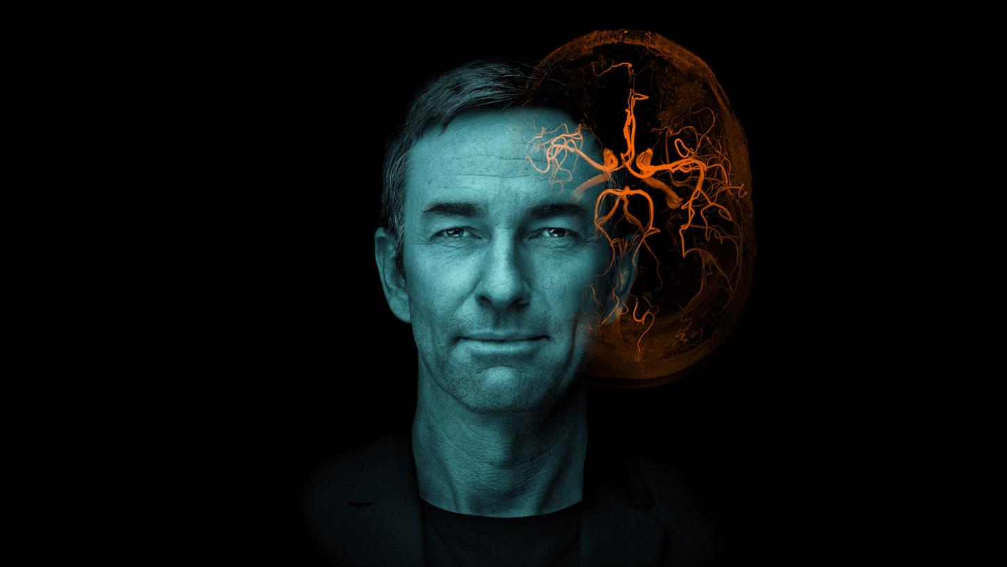 Siemens Healthineers AT Esmint Congress Neurovascular stroke