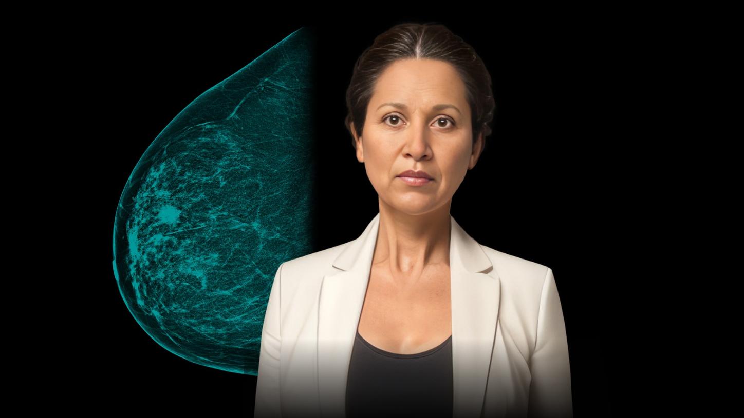 Breast cancer patient journey