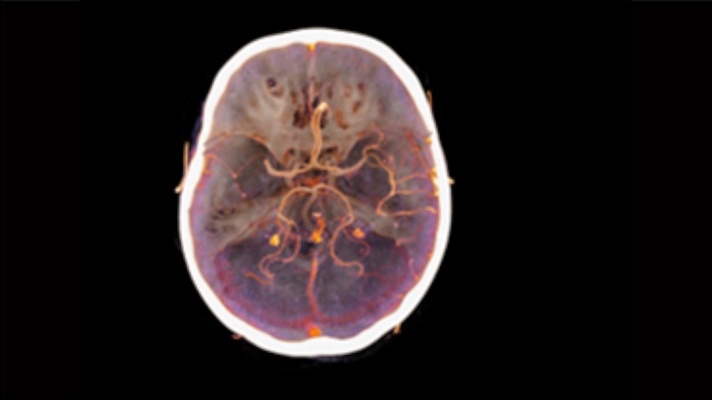 Clinical Specialties Stroke Focus
