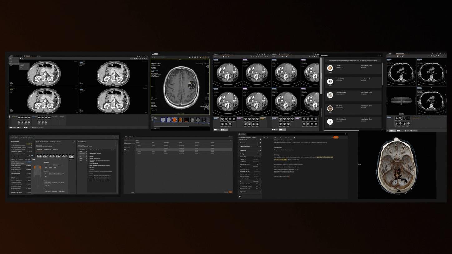 AI in radiology