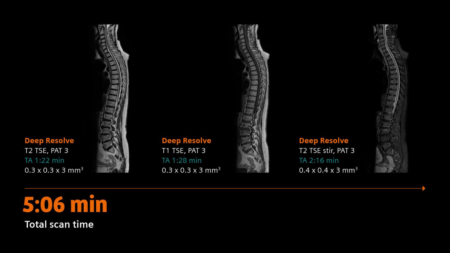 Clinical image - Spine