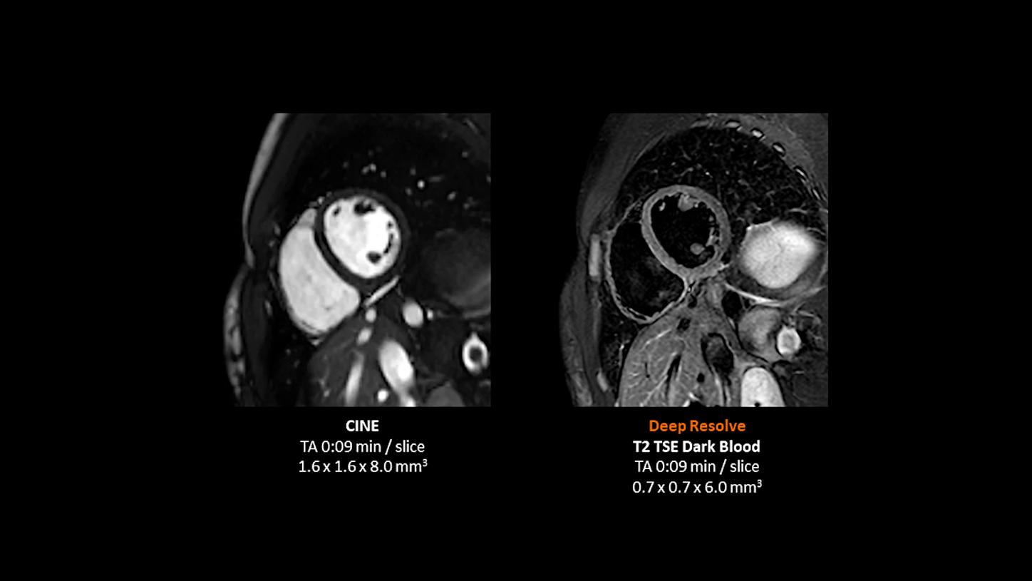 Clinical image - Cardiac