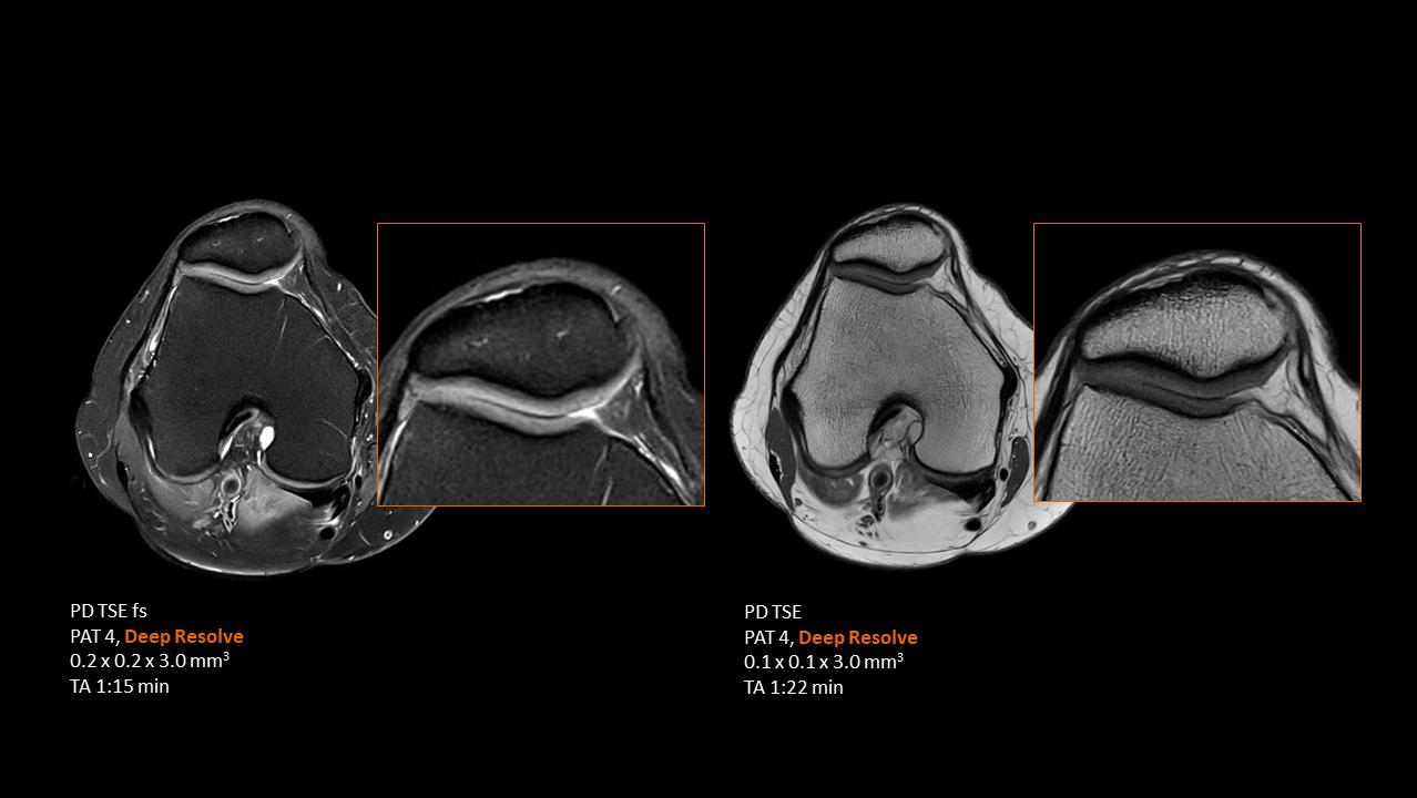 Clinical image - MSK