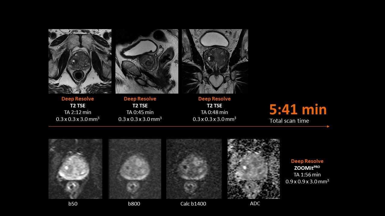 Clinical image - Prostate