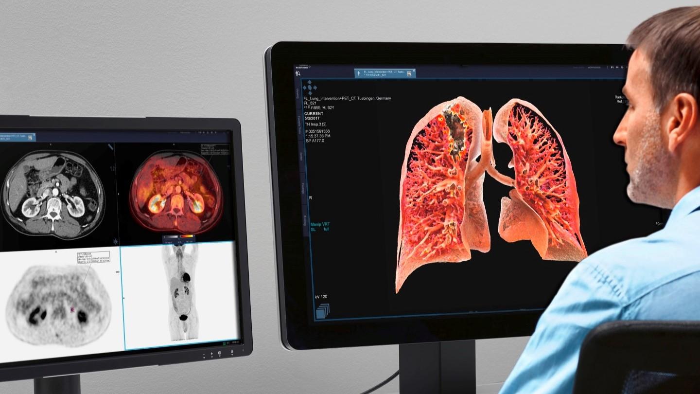 Siemens Healthineers - syngo.via - Advanced Visualization