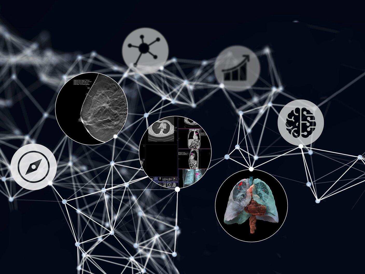 Digital Transformation of Radiology