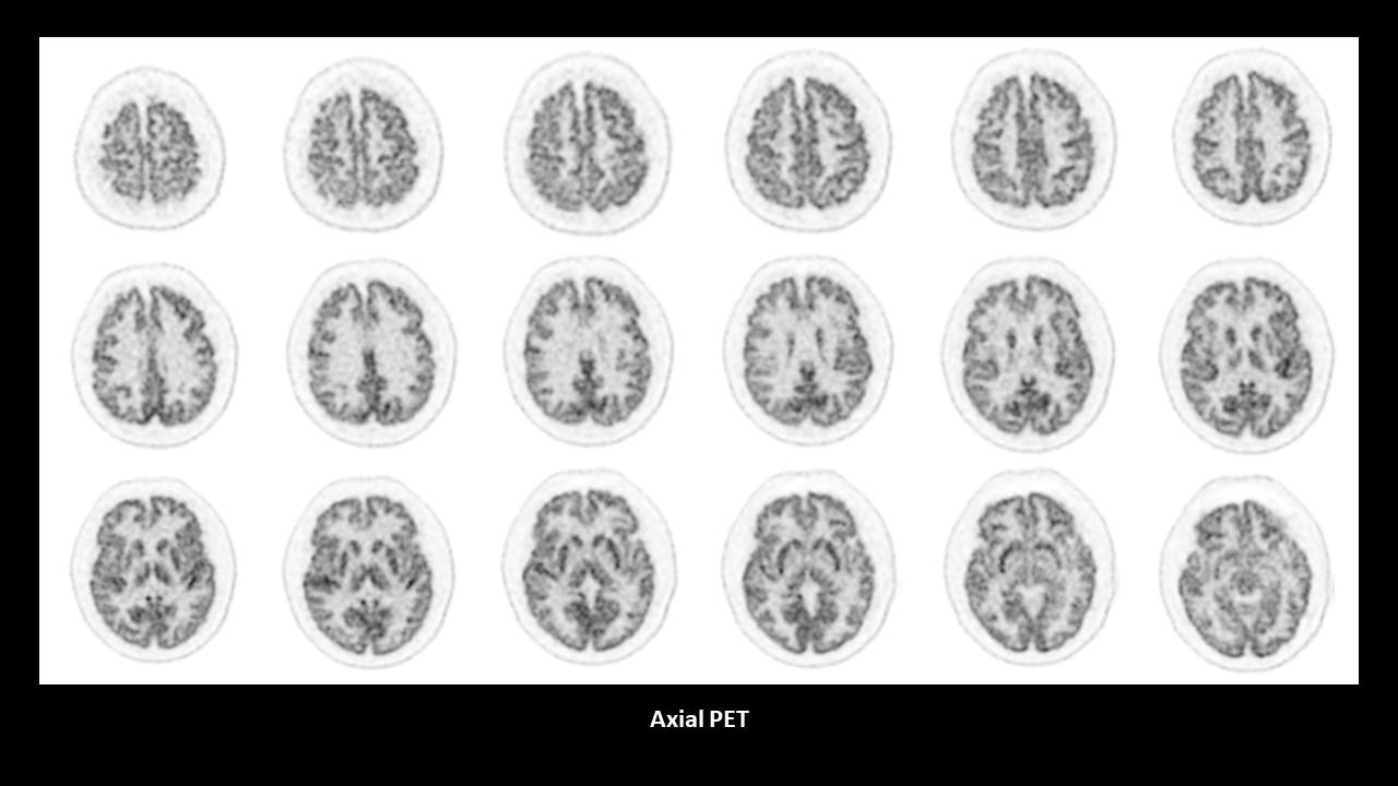 Optiso FAST detector provides high spatial resolution and image quality