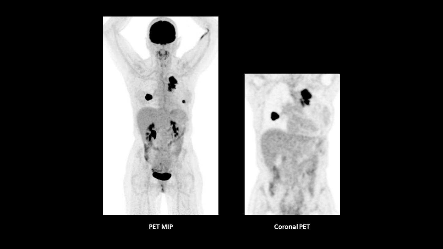 Optiso FAST digital detector enables imaging speed and precision