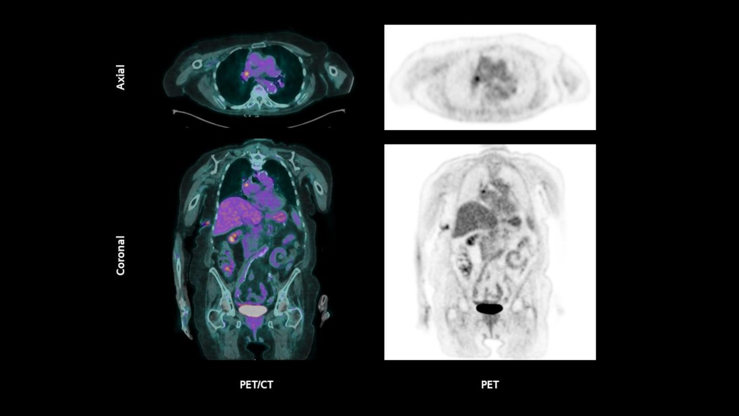 Achieve high image quality while lowering scan times and injected dose