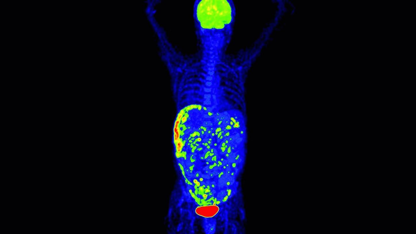 syngo.via check mark