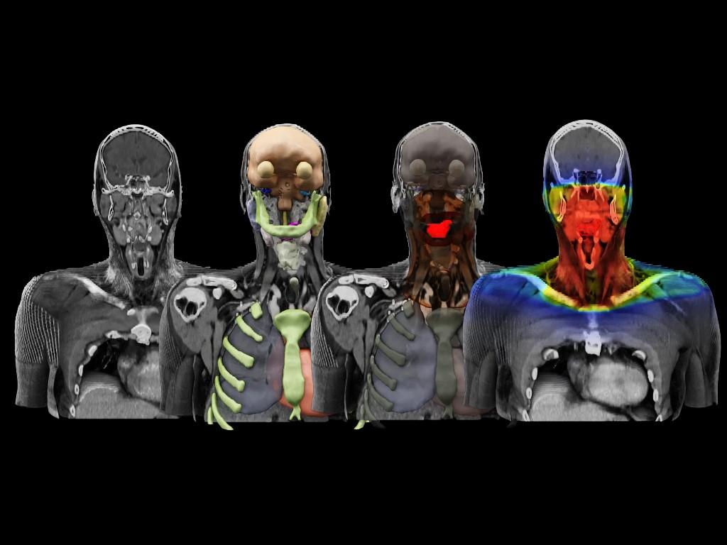 Siemens Healthineers CT in RT