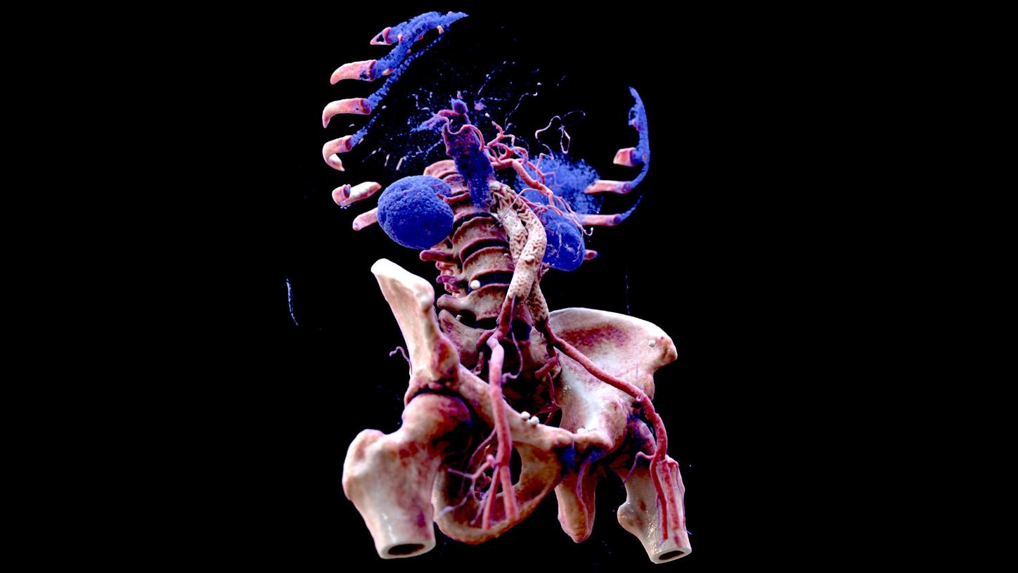 syngo.via Cinematic VRT