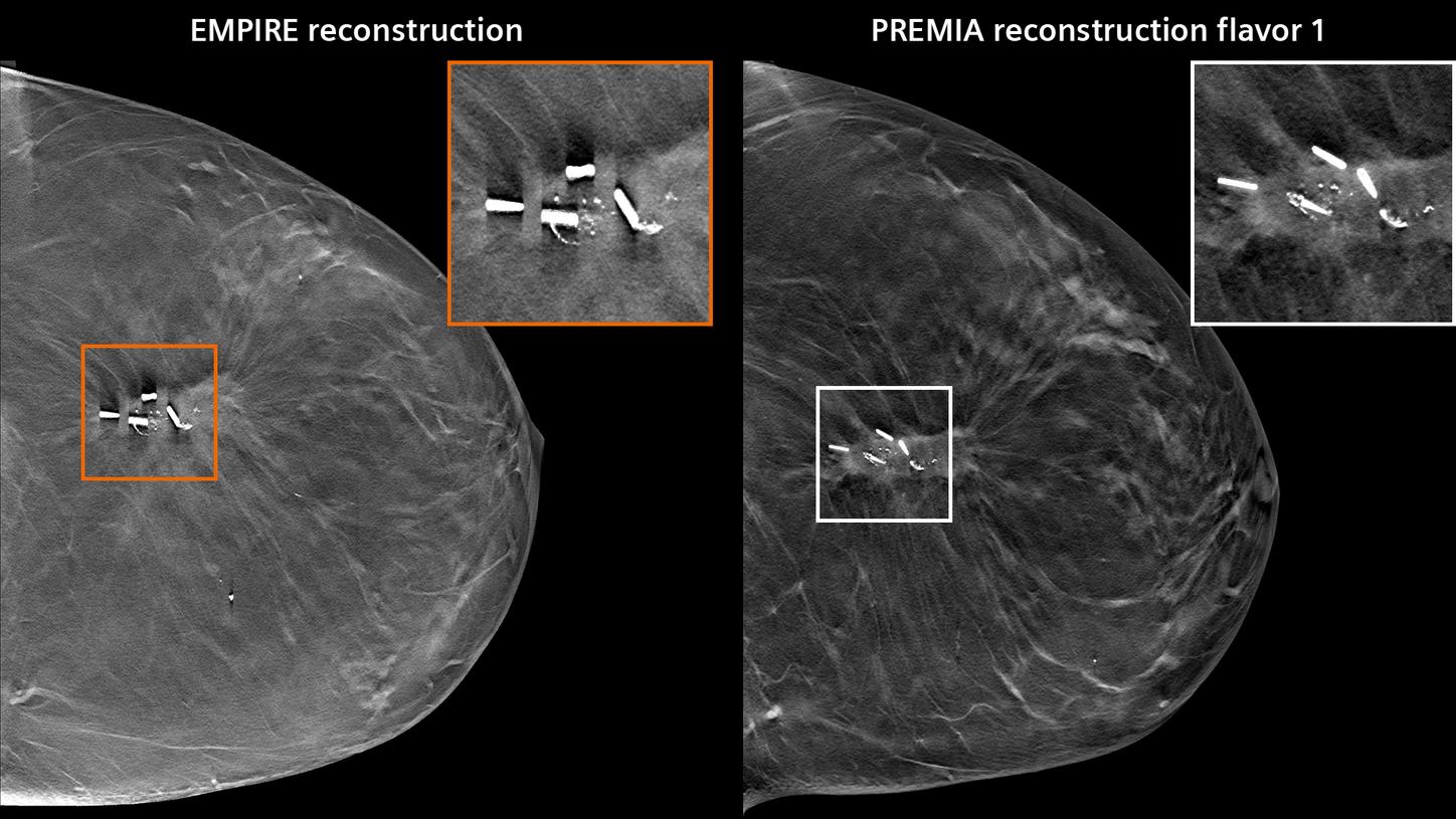 Comparison of EMPIRE and PREMIA reconstruction.