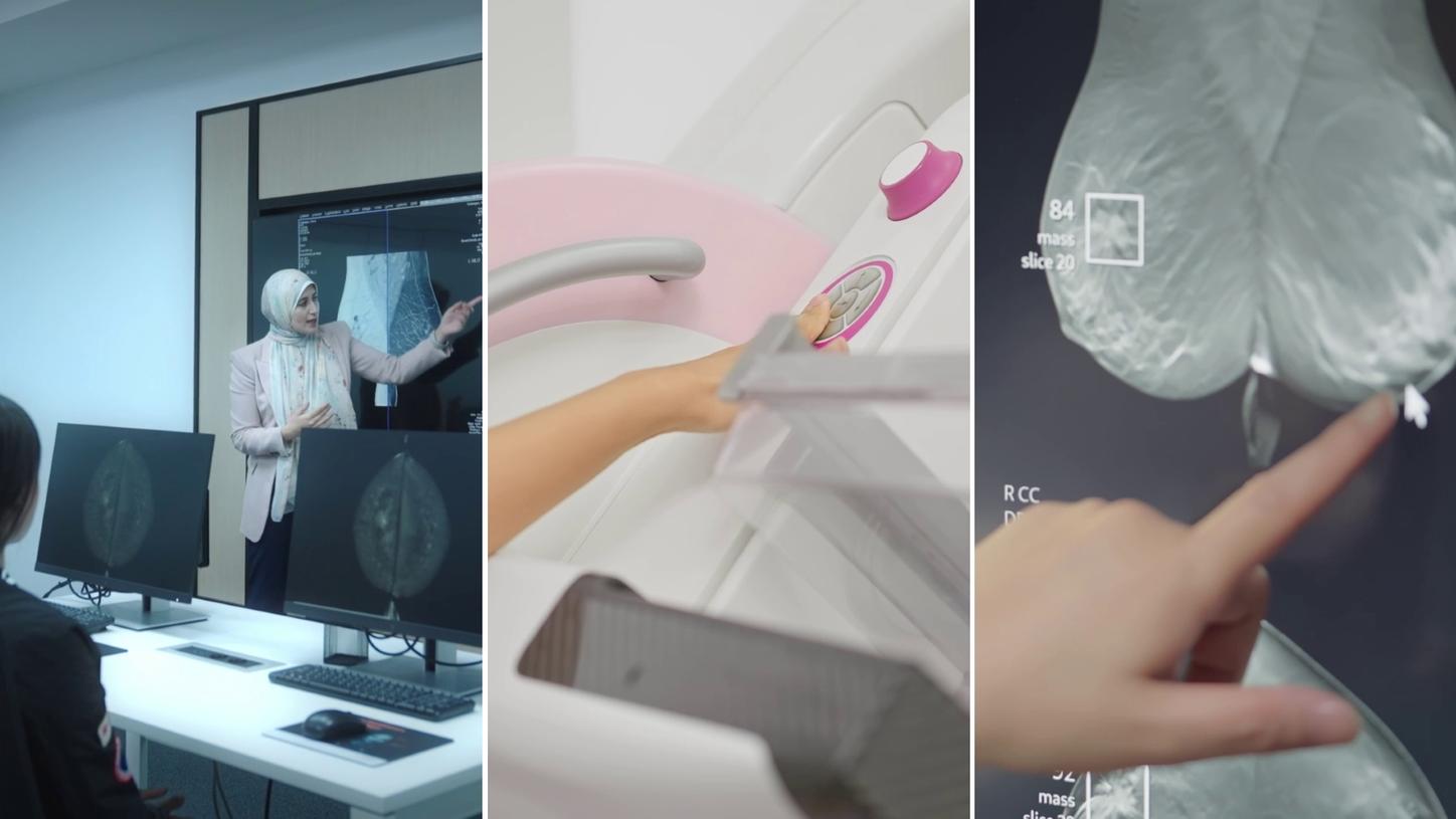 collage with pictures on training on breast cancer screening, and clinical image