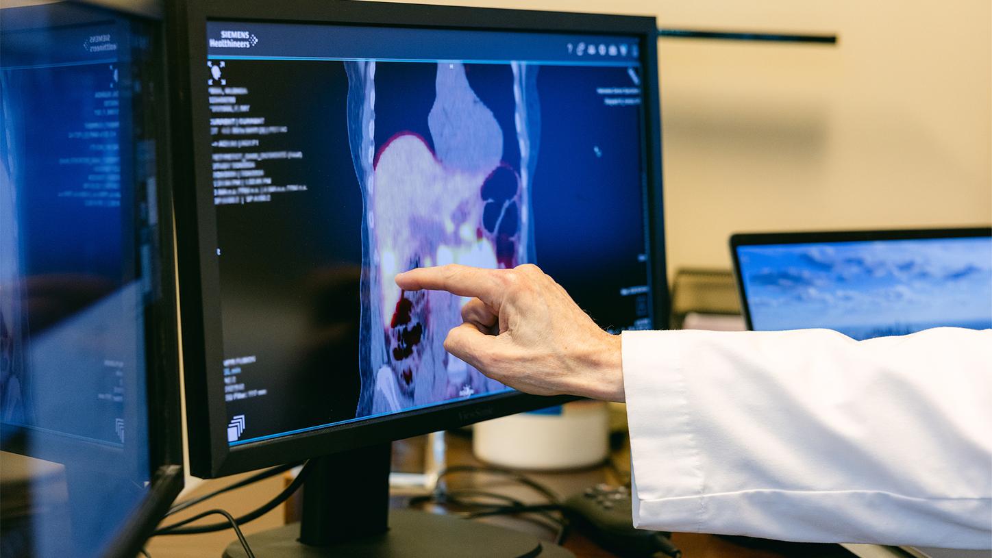 Samuel Mehr, MD, director of Nuclear Oncology at NCS, and Glenda discuss results of the theranostics treatment.