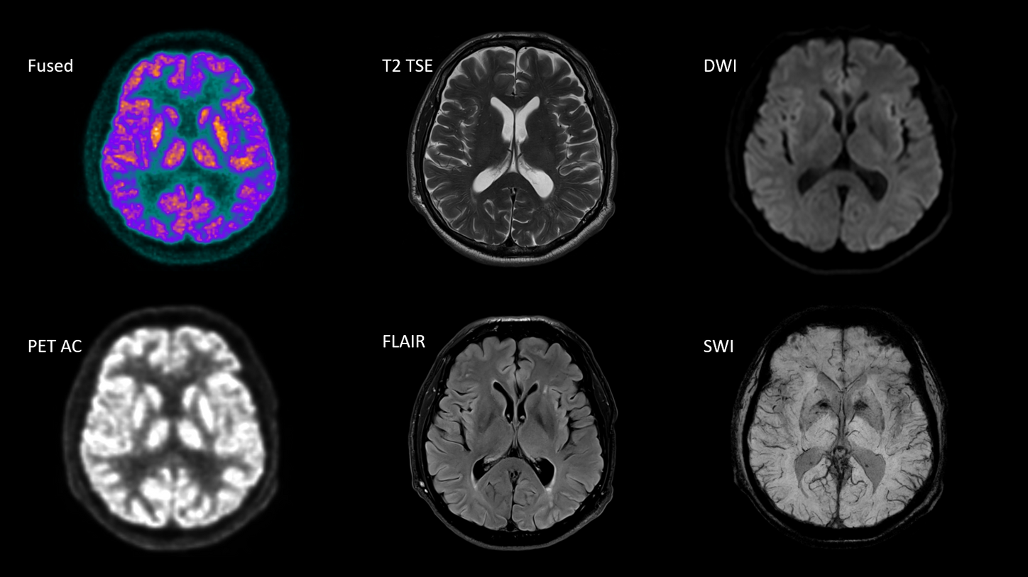 Brain imaging – BIOGRAPH One