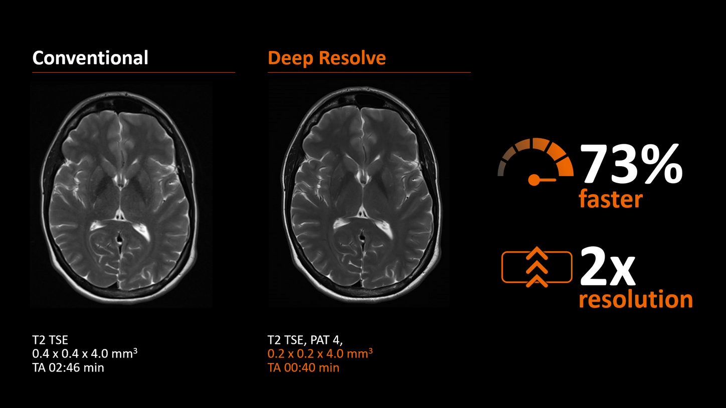 Deep Resolve designed to make PET/MR exams faster than ever before