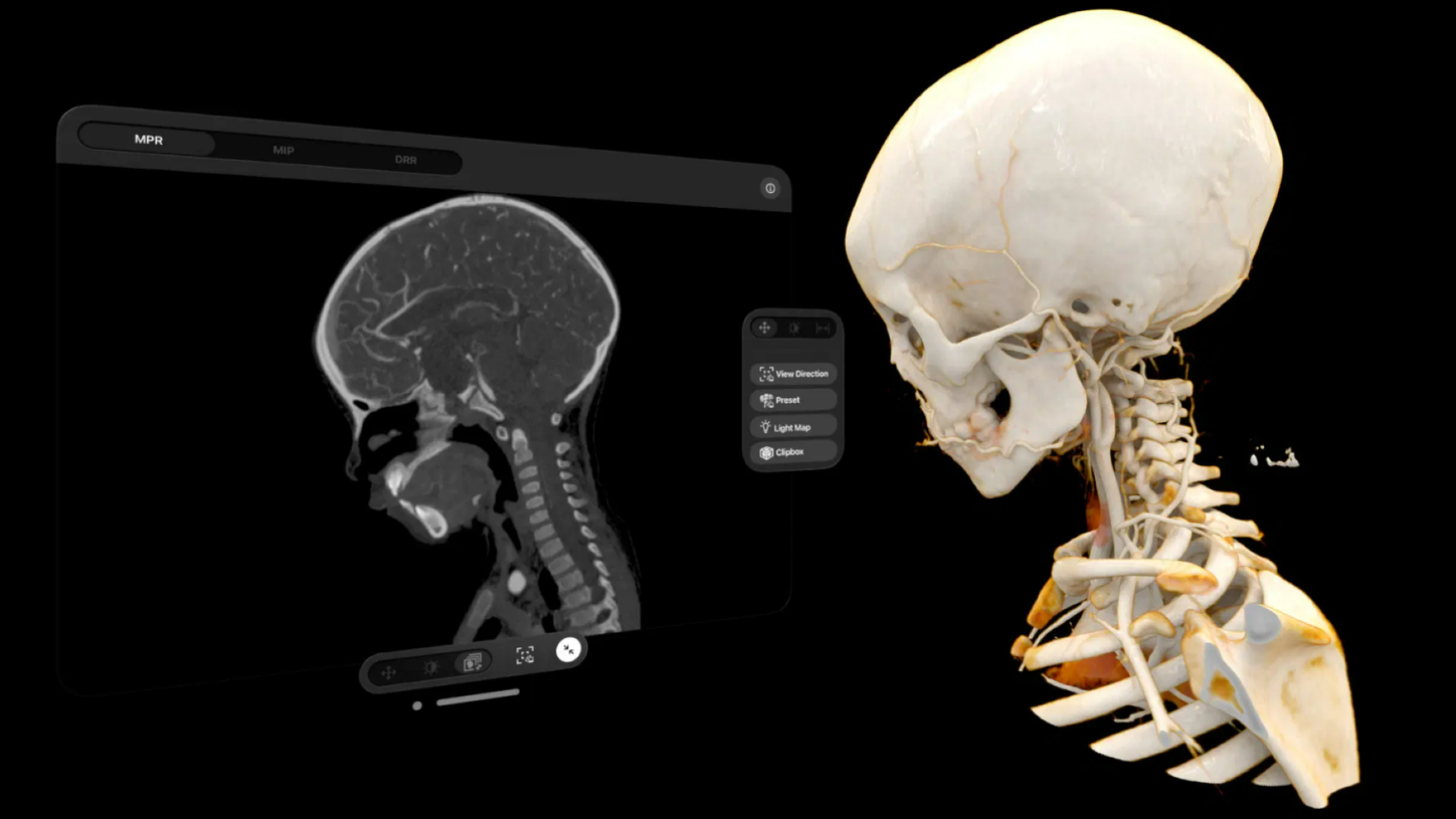 AI in radiology Communication