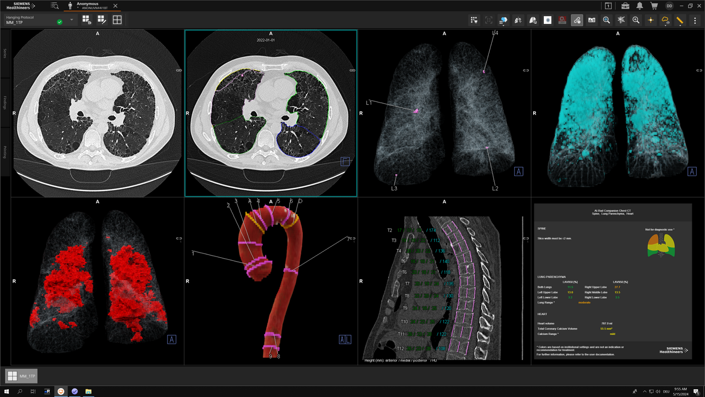 AI in radiology History and scheduling