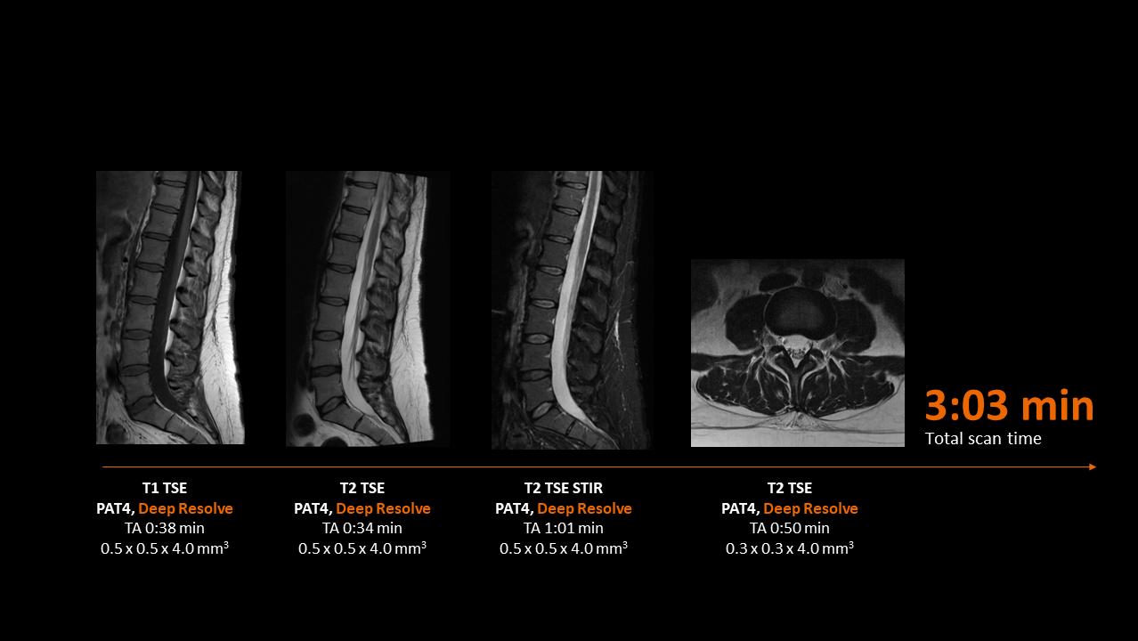 Clinical image - Spine
