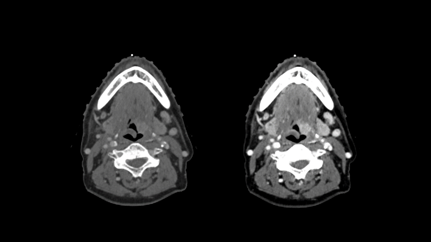 Unlock the power of your images syngo.via