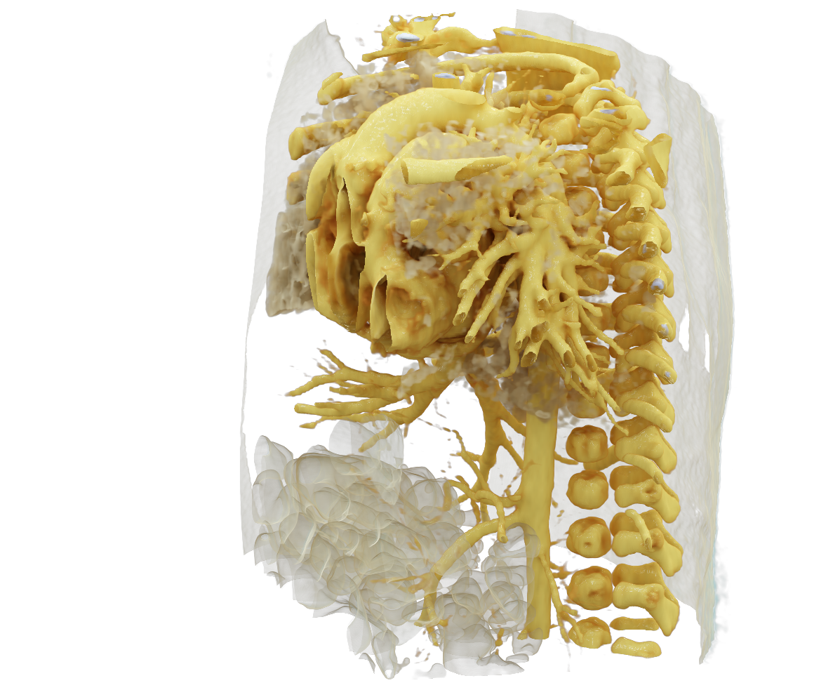 Spacial presentation of the heart in 3D