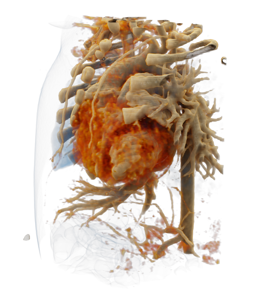 Spacial presentation of the heart in 3D