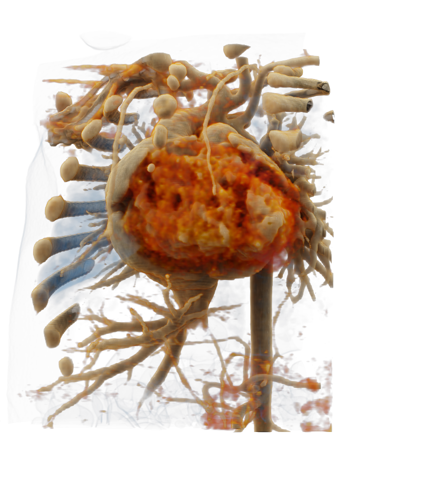 Spacial presentation of the heart in 3D